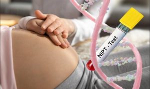 NIPT Testing Cost in India: What Parents Should Know Before Booking