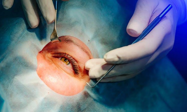 Understanding Different Types of Cataract Surgery: Which One is Right for You?